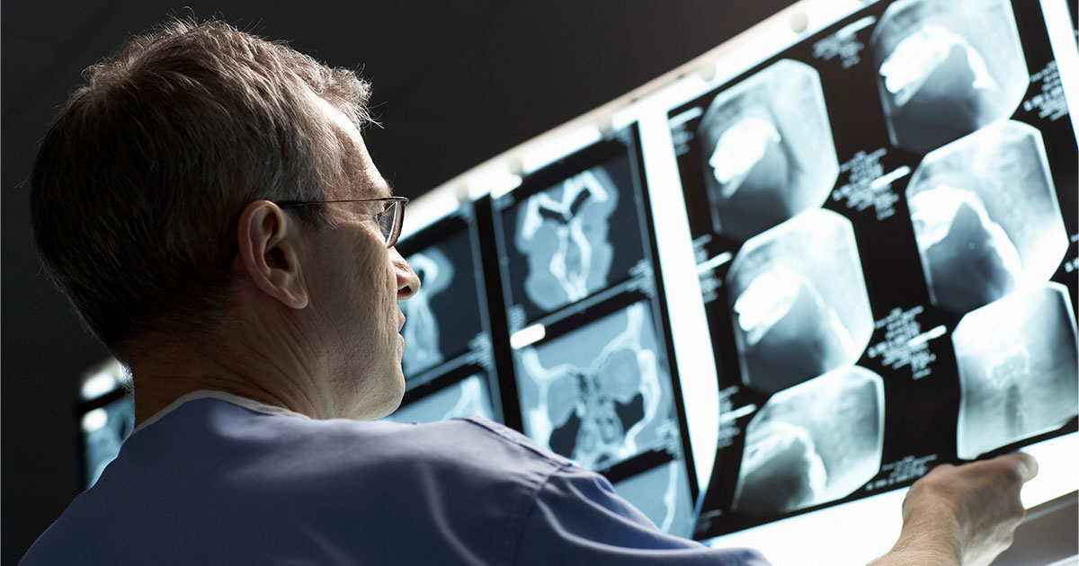 AI's Transformative Role in Radiology